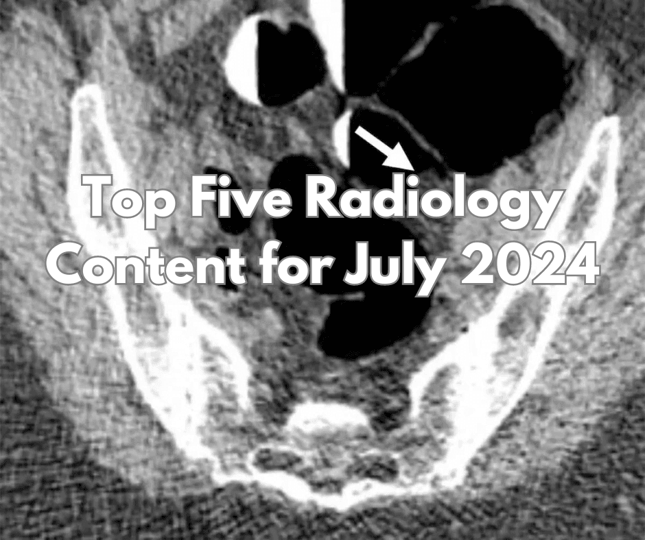 Top Five Radiology Content for July 2024