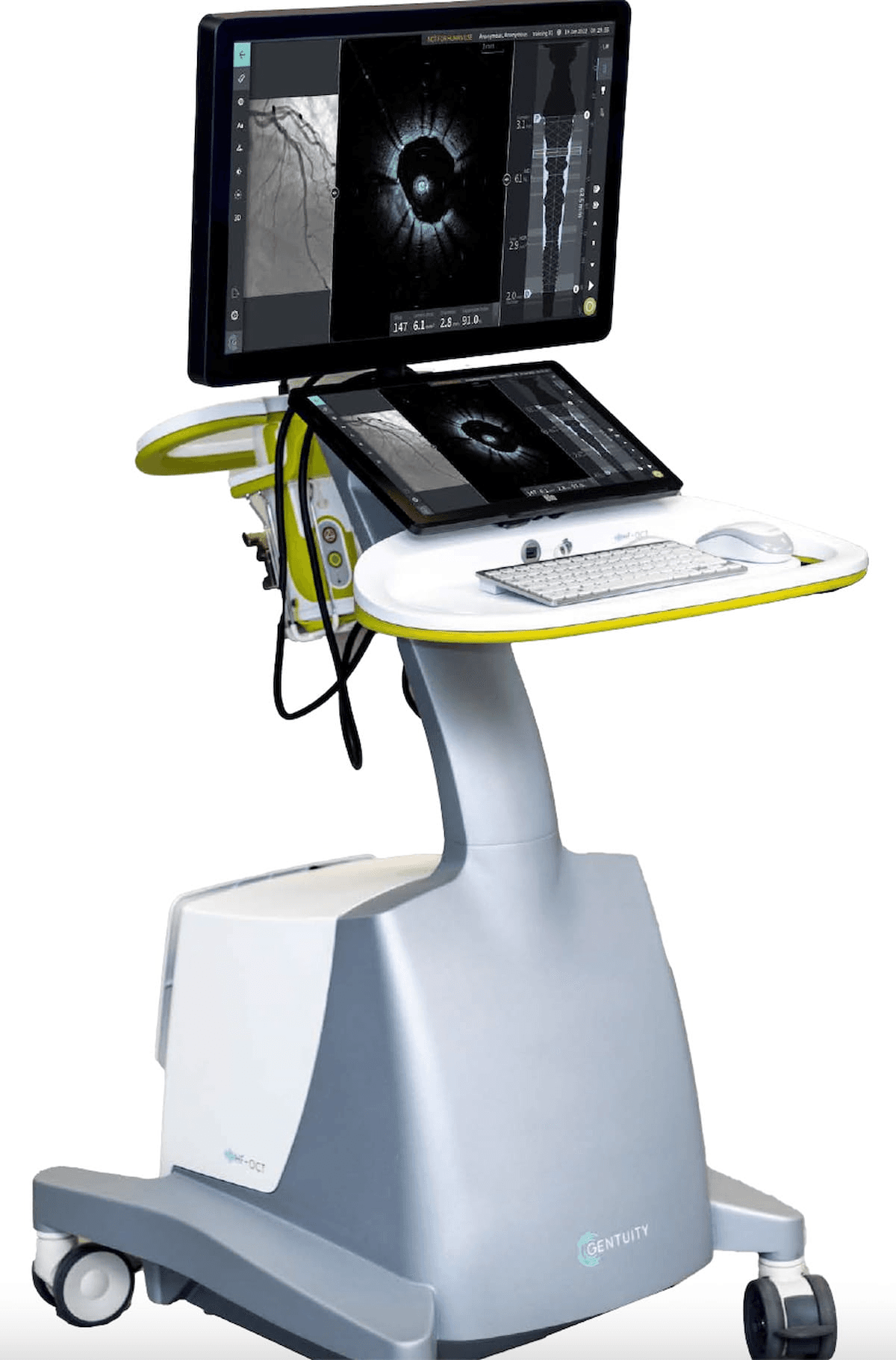 FDA Grants Expanded Clearance of Intravascular Imaging System for Use with Percutaneous Coronary Interventions