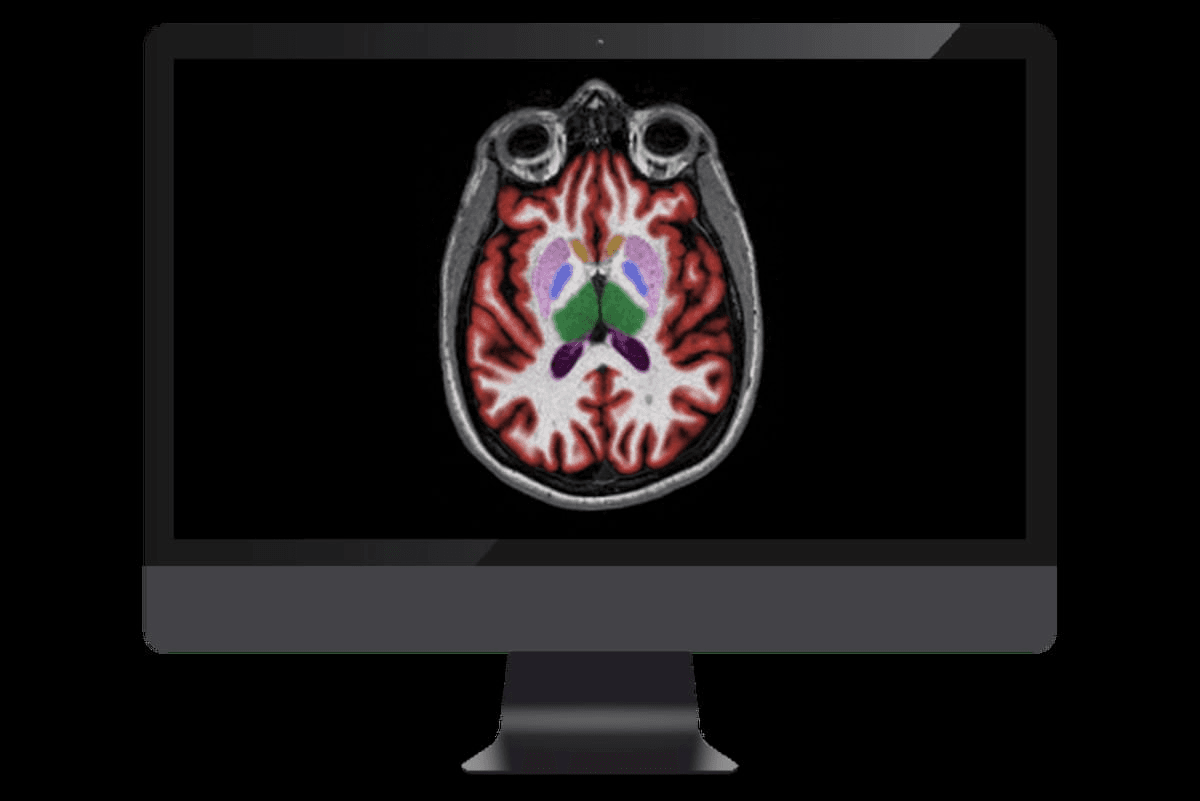 FDA Clears Updated AI Software for MRI Neuroimaging 