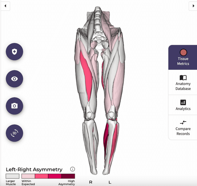 FDA Clears AI-Powered Muscle Health Analysis Derived from Rapid MRI Scans