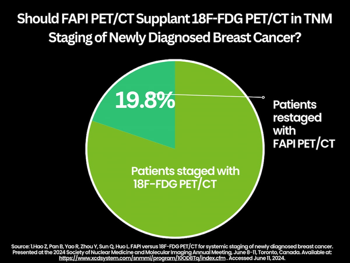 SNMMI: New Study Suggests Merits of FAPI PET/CT for Breast Cancer Staging