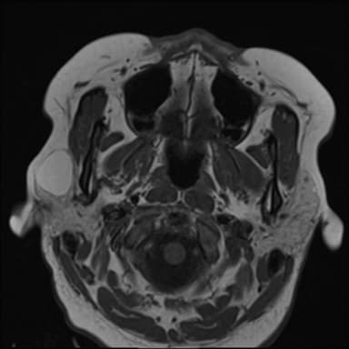 Image IQ: Right Face Swelling