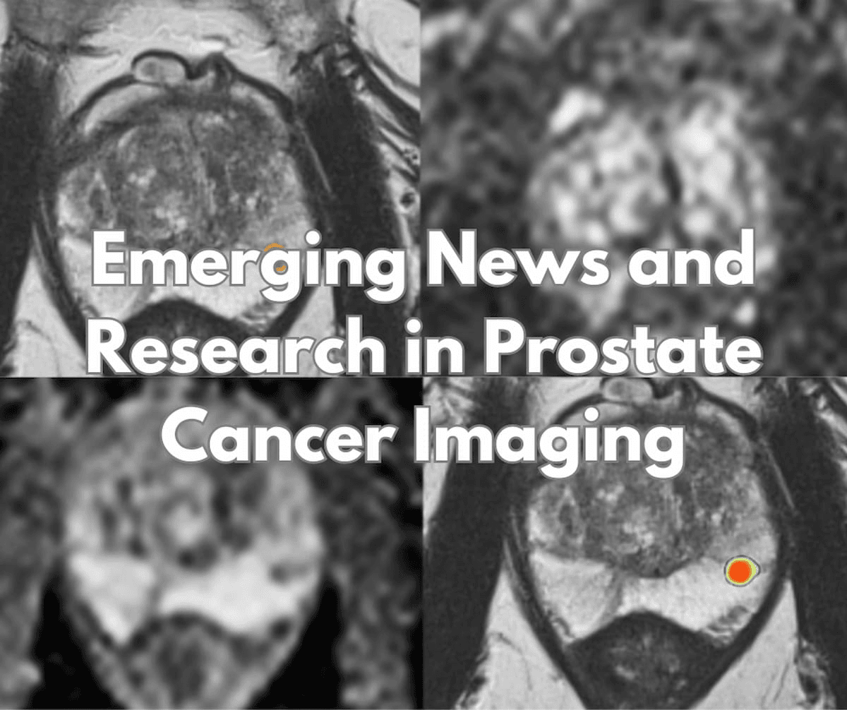 Emerging News and Research in Prostate Cancer Imaging — July 2024