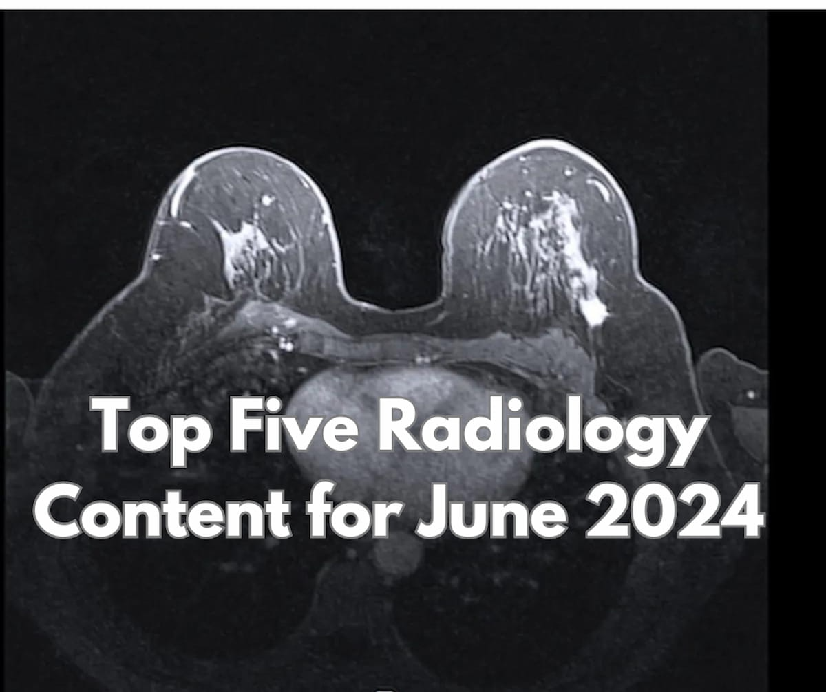 Top Five Radiology Content for June 2024