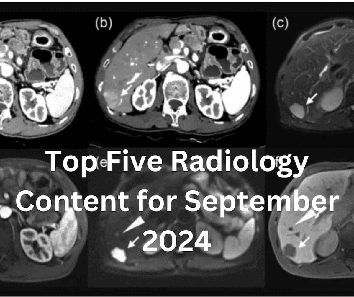 Top Five Radiology Content for September 2024