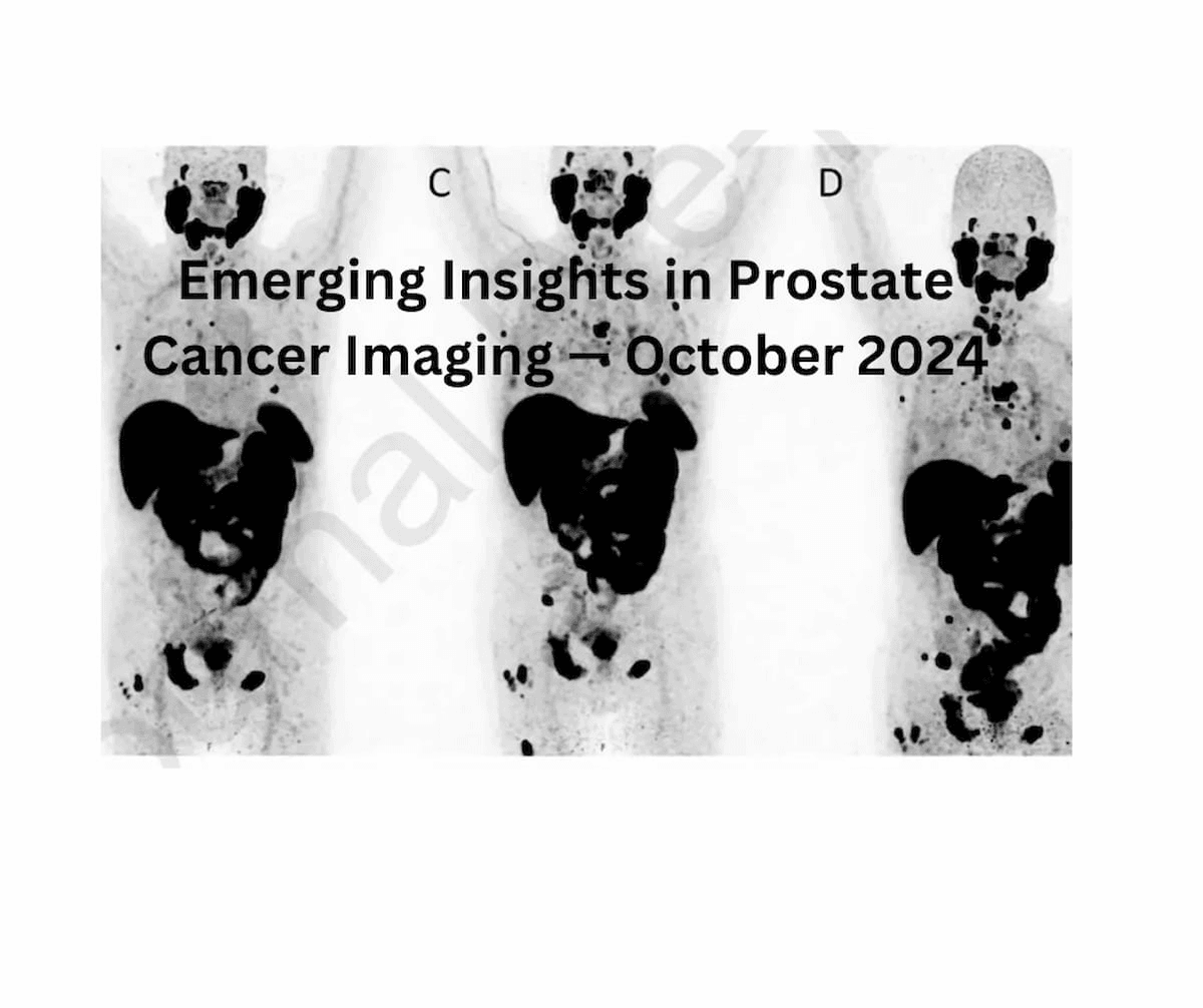 Emerging Research in Prostate Cancer Imaging — October 2024