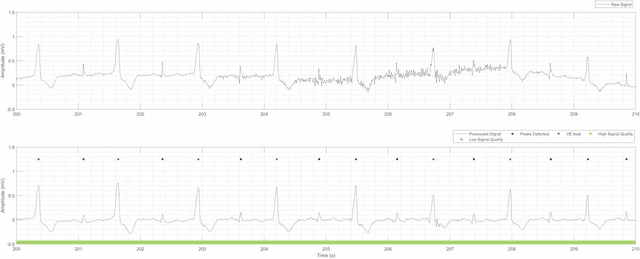 FDA Clears New Electrocardiogram Suite of Algorithms and Analytics