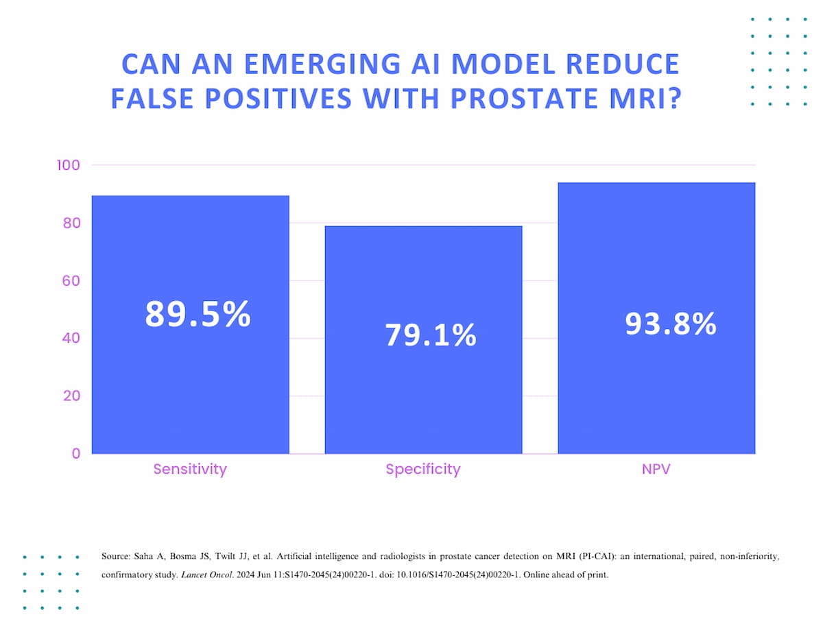 MRI-Based AI Model Facilitates 50 Percent Reduction in False Positives for Prostate Cancer