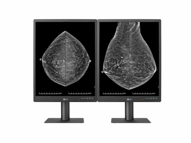 LG Debuts 5MP High-Definition Mammography Monitor