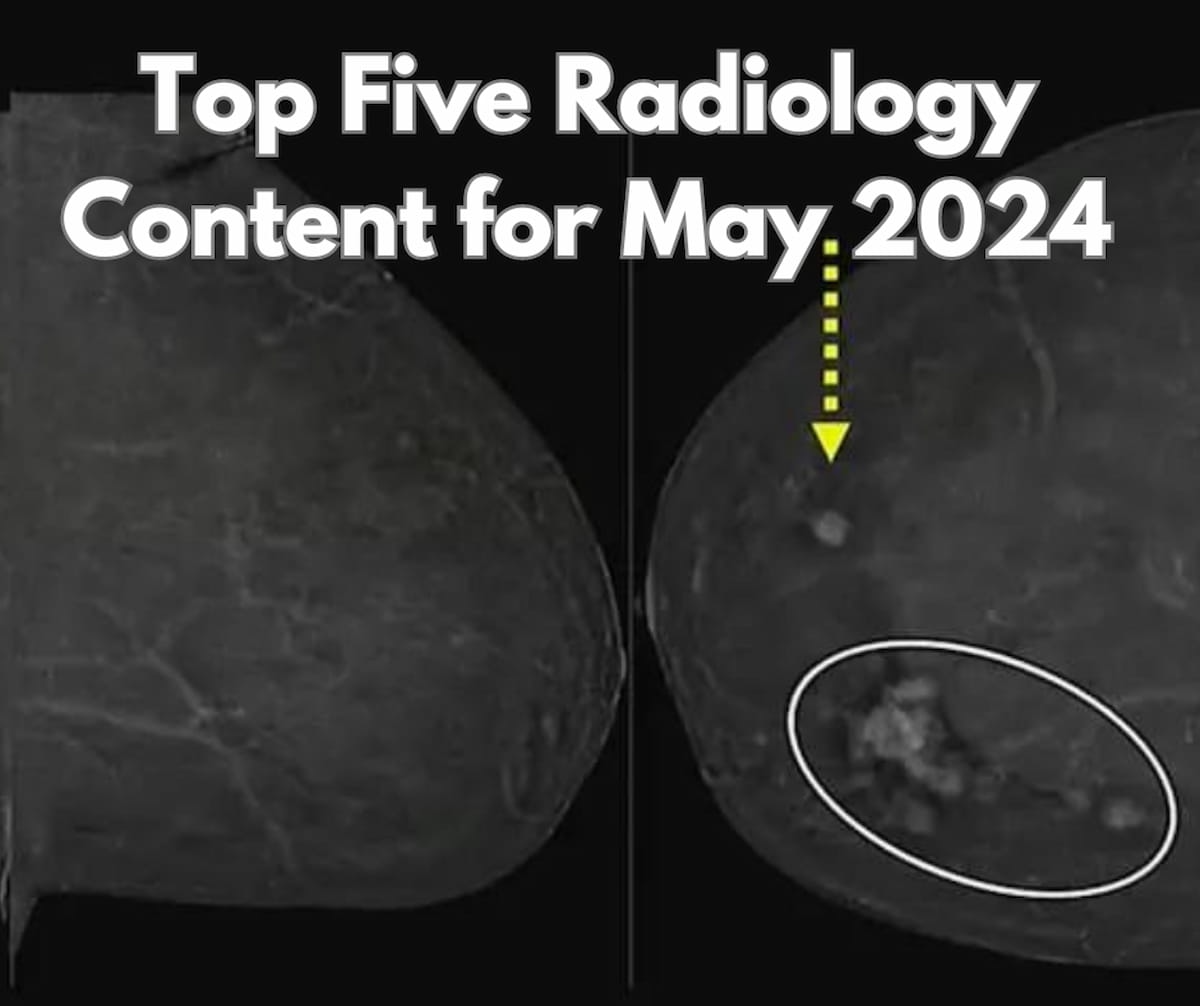 Top Five Radiology Content for May 2024