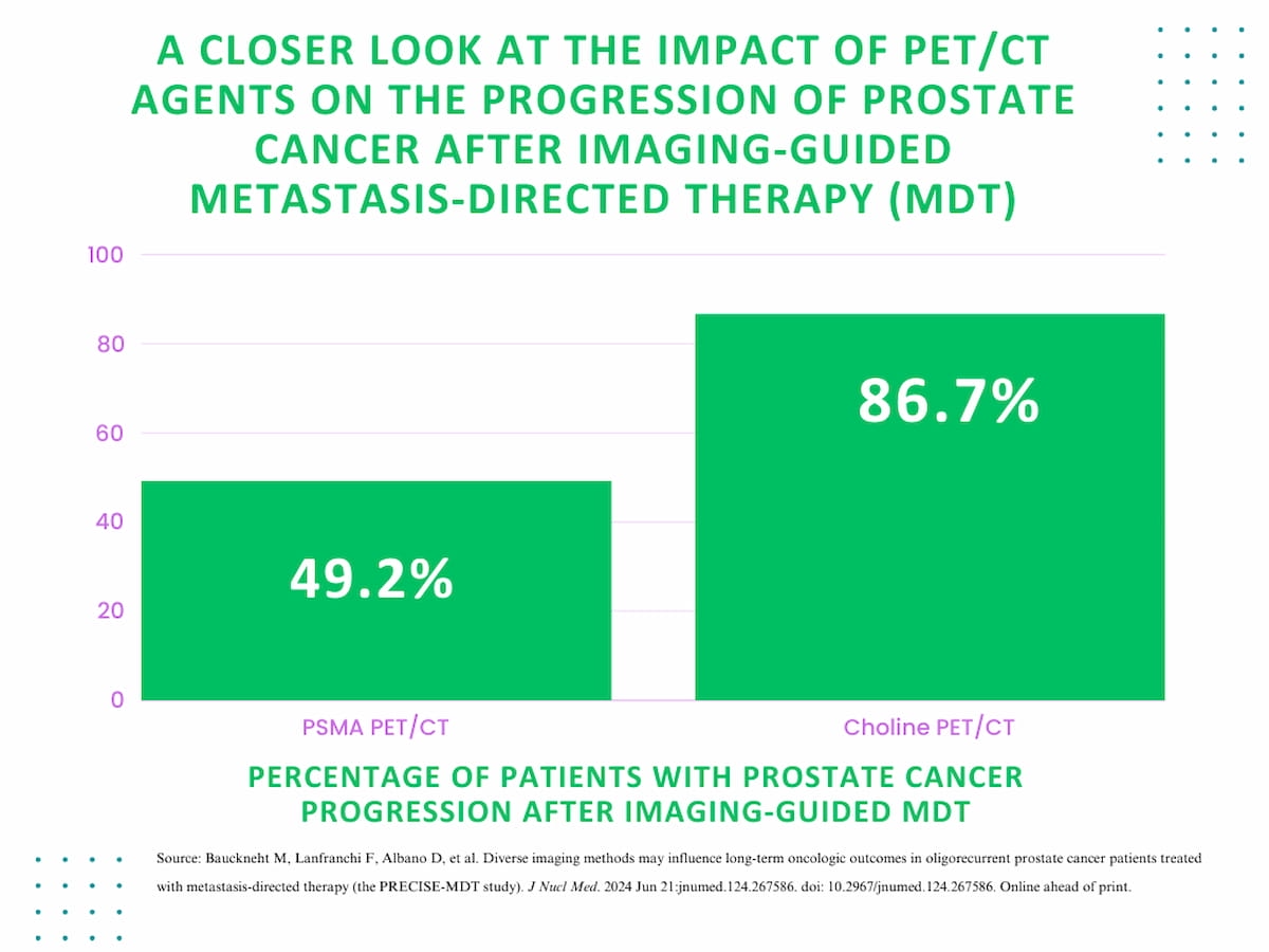 What New Research Reveals About PSMA PET/CT and Oligorecurrent Prostate Cancer
