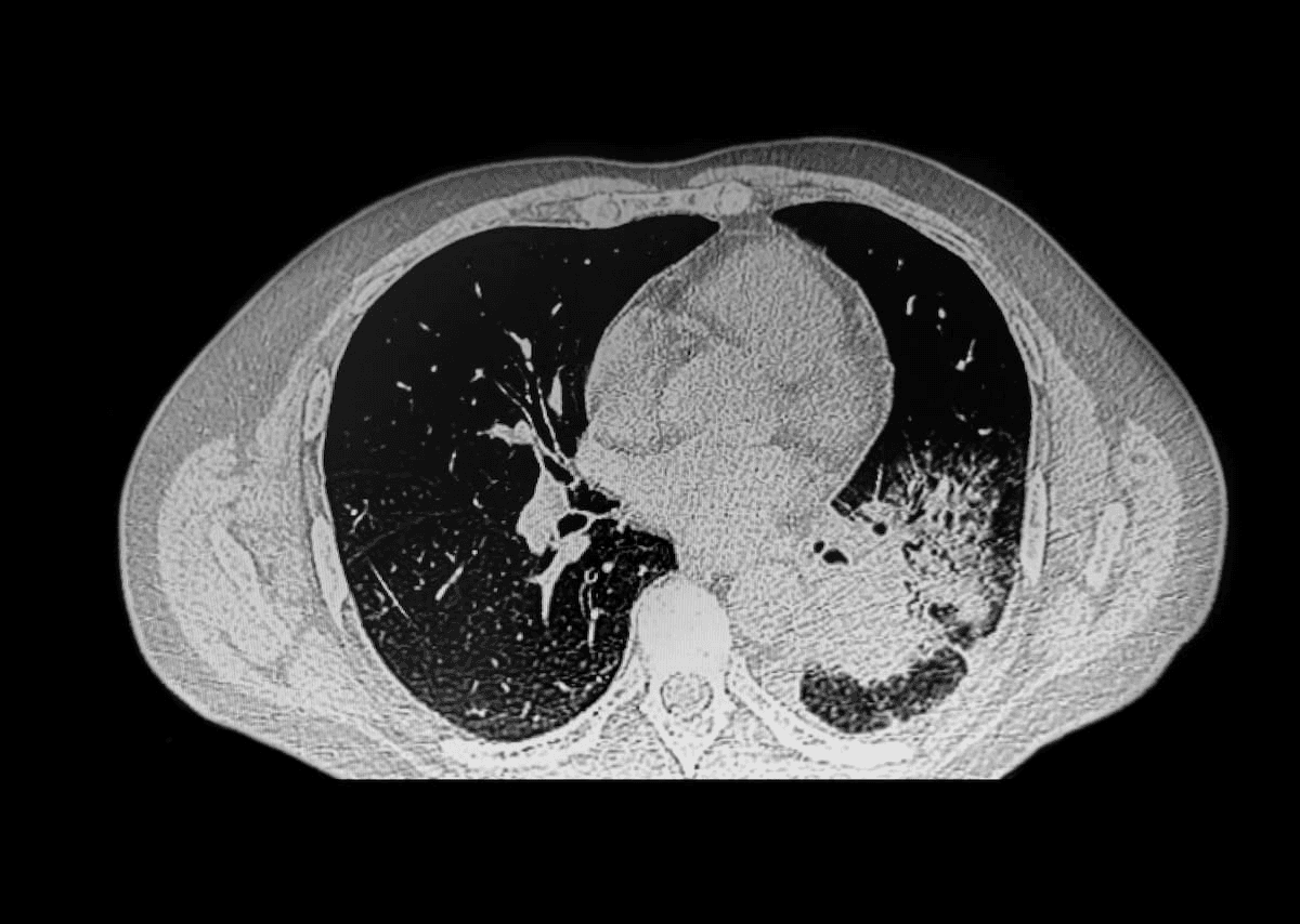 New Study Examines Agreement Between Radiologists and Referring Clinicians on Follow-Up Imaging