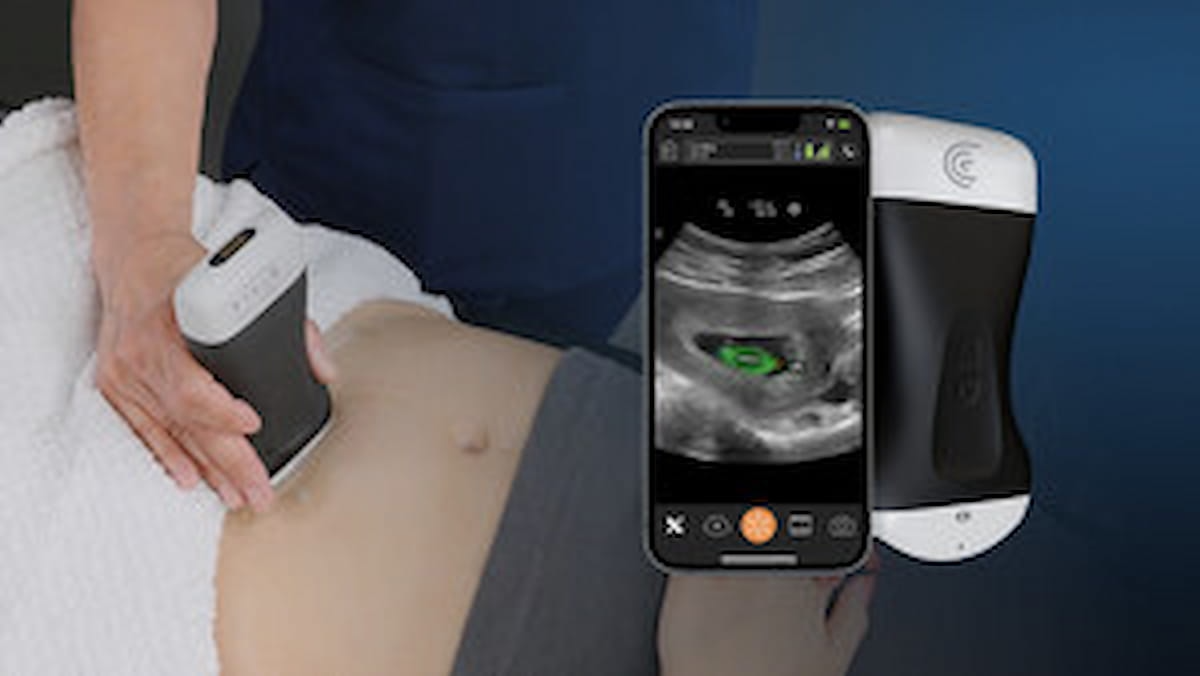 FDA Clears AI-Powered Ultrasound Tool for Fetal Biometric Measurements