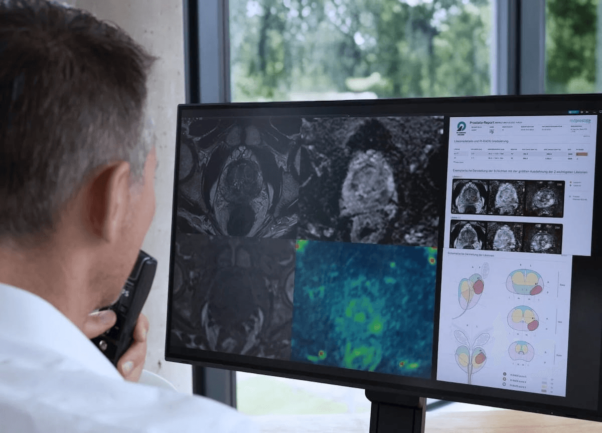 Emerging AI Platform Shows Promise for Prostate Cancer Detection on mpMRI