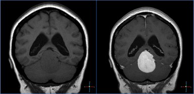 Image IQ Quiz: Patient Presents with Dizziness