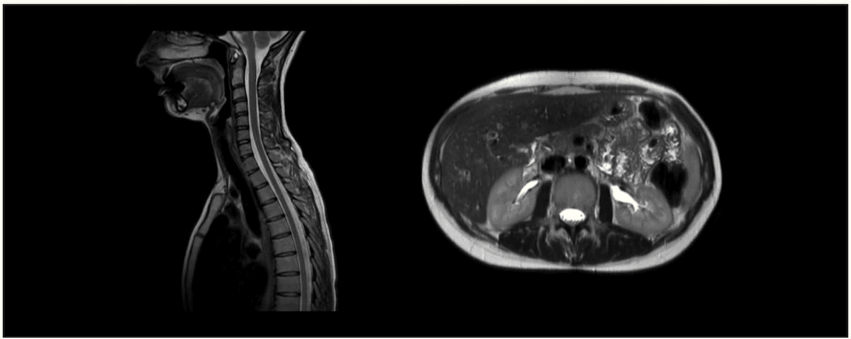 Ezra Launches 3T MRI/CT Combination for Full-Body Scans