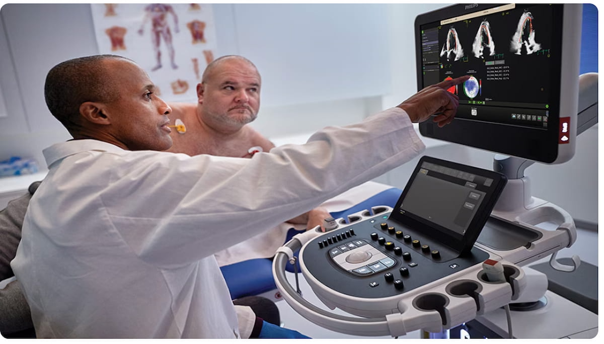 New Cardiac Ultrasound AI Applications from Philips Gets FDA Nod