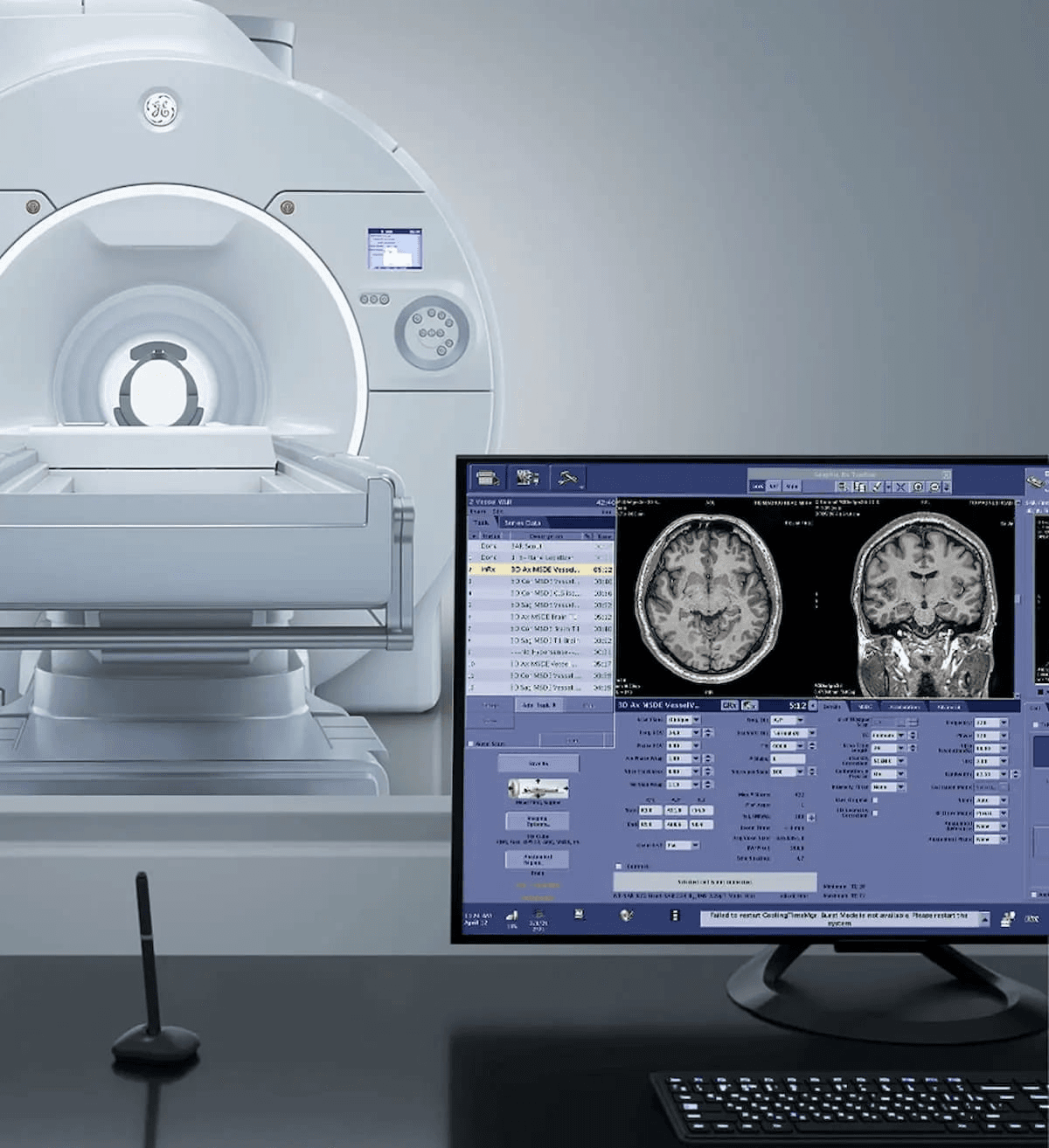 3T Head-Only MRI System Gets FDA Clearance