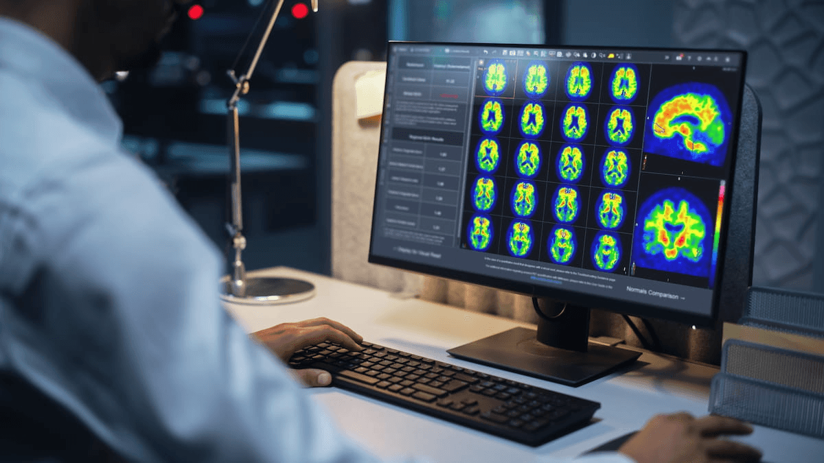 FDA Clears PET-Based Software for Centiloid Scaling of Amyloid Plaque Density