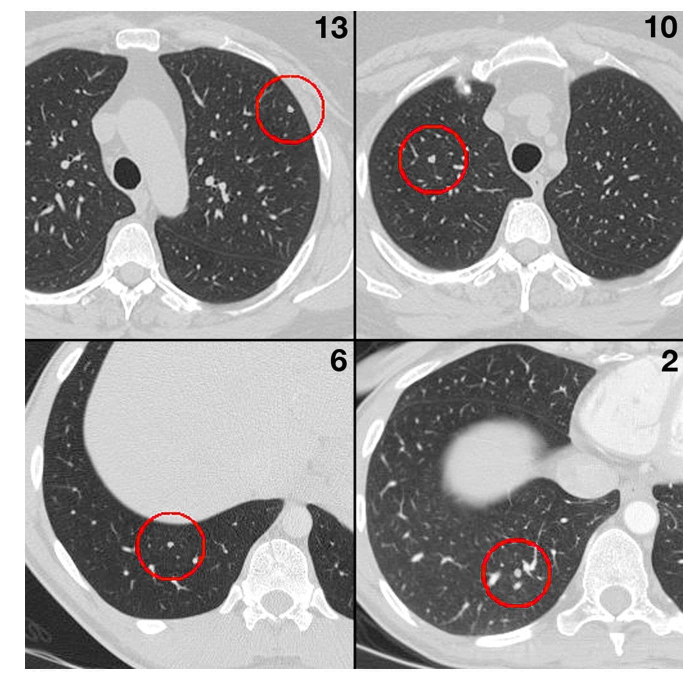 Radiologists Actively Search Less than Half of Lung on CT