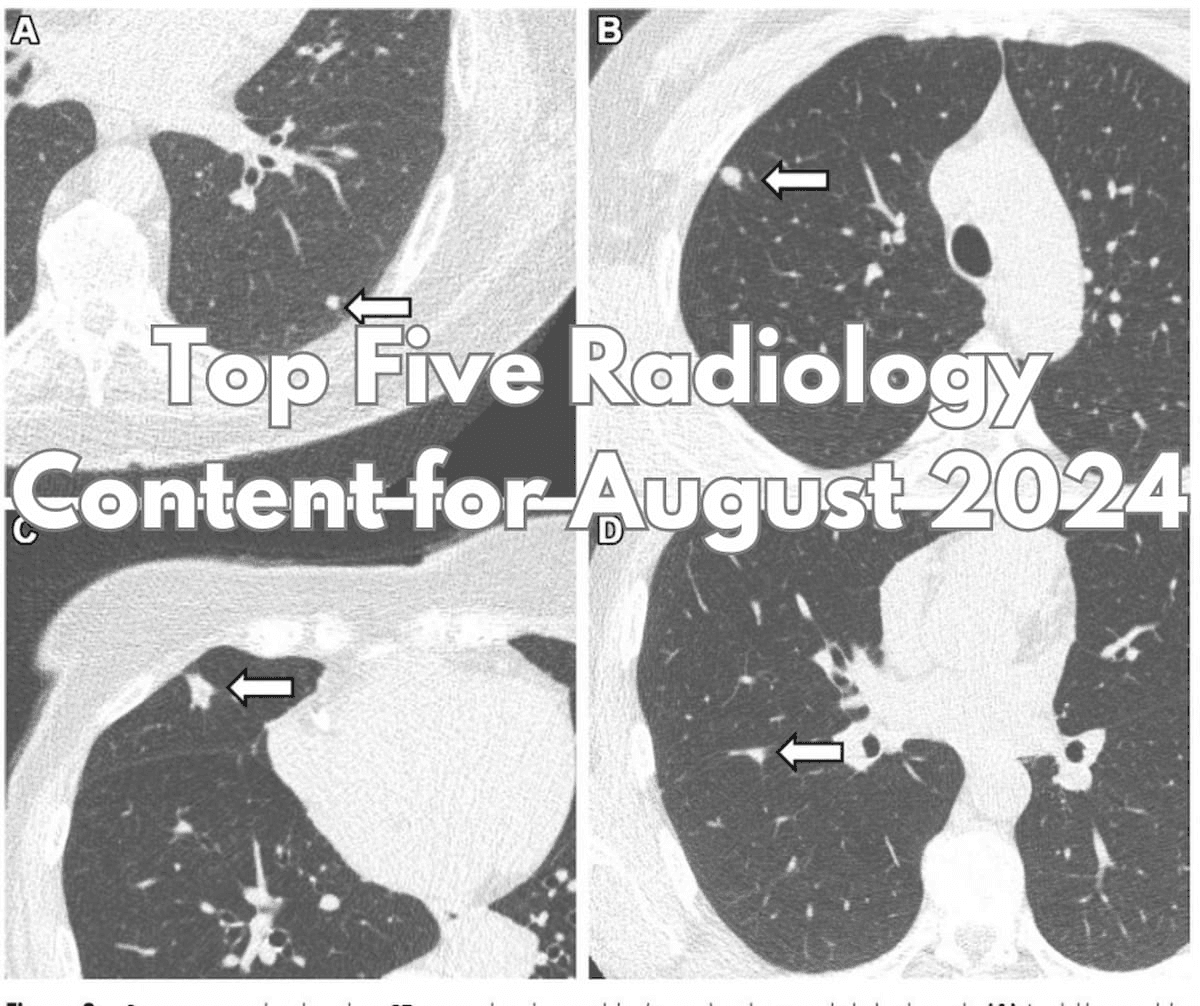 Top Five Radiology Content for August 2024