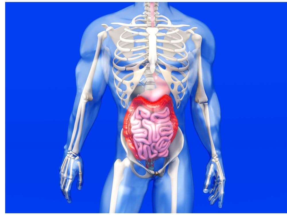 PET/MR Enterography for Stricture Differentiation in Crohn Disease